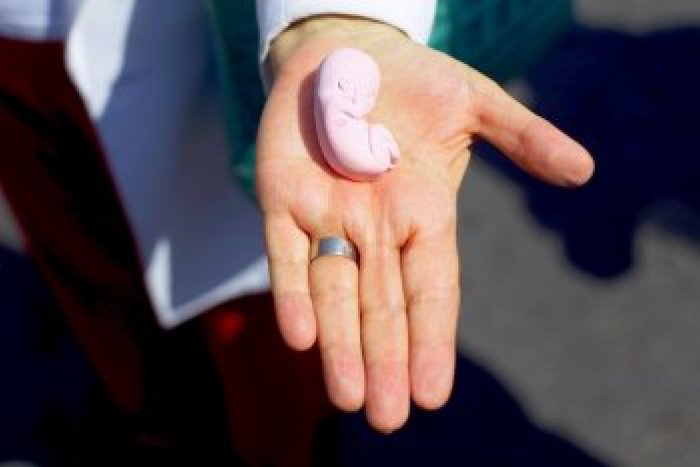 Ilustračný obrázok k článku Pohľad, z ktorého až mrazí: V čističke objavili mŕtvy detský plod!