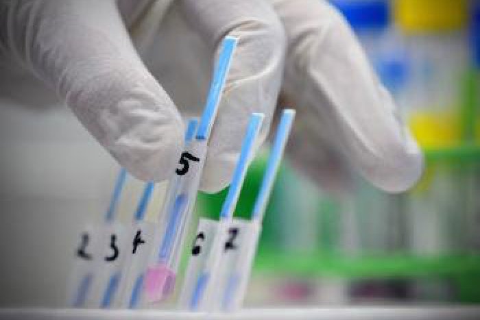 Ilustračný obrázok k článku V Bystrici potvrdili prípady žltačky: Zákerným vírusom sa nakazili deti!