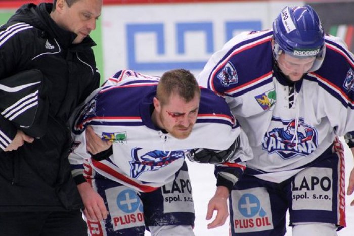 Ilustračný obrázok k článku Ťažké chvíle nitrianskeho odchovanca: Garipovi Salijimu hrozí strata zraku a koniec kariéry