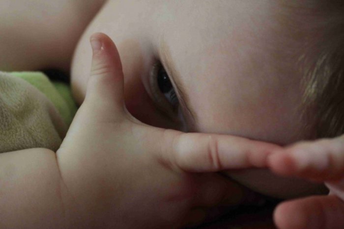 Ilustračný obrázok k článku Sibylka (2) potrebuje pomoc! Kremničania pre ňu organizujú beh na Skalke