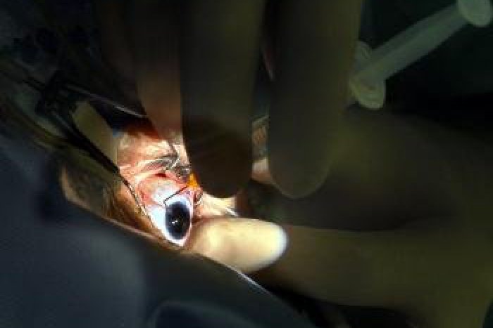 Ilustračný obrázok k článku Vedecké dni na Sliači: Účastníci trénovali operáciu oka na špeciálnom simulátore