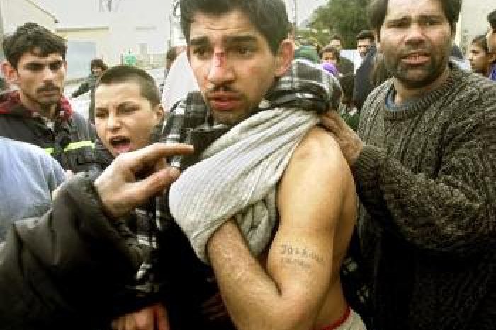 Ilustračný obrázok k článku Nepokoje v osade v Krompachoch: Rómovia na seba útočili vidlami aj mačetami!