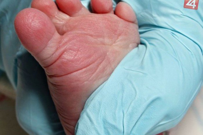 Ilustračný obrázok k článku Prvé novoročné bábätko v Žiline: Sebastián prišiel na svet 70 minút po polnoci