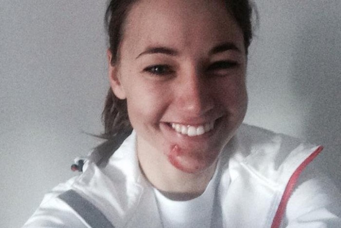 Ilustračný obrázok k článku Prvý tréning v Soči Zuzke Stromkovej veľmi nevyšiel: Takto dopadla jej brada