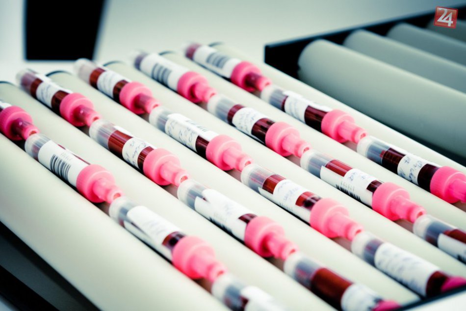 Ilustračný obrázok k článku ÚVN ĎAKUJE: Počet darcov, ktorí prišli na odber krvi, považuje za zázrak!