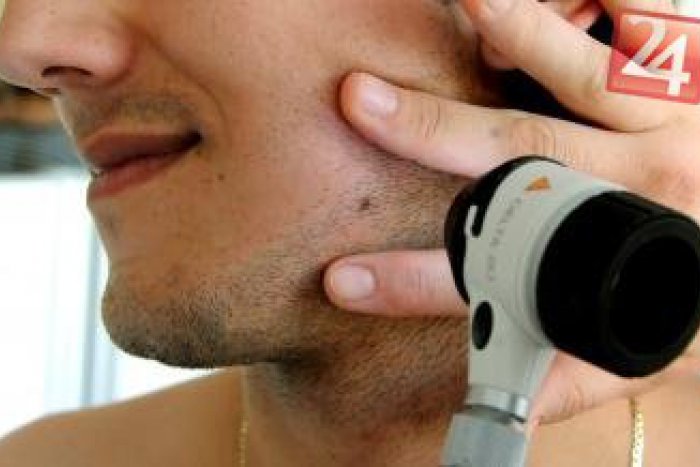 Ilustračný obrázok k článku Univerzitná nemocnica stavila na prevenciu:  Lekári vám zdarma vyšetria vaše znamienka