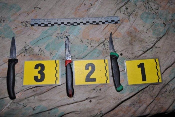 Ilustračný obrázok k článku Krvavý atak neďaleko Žiliny: Najskôr hádka, potom útok nožom!