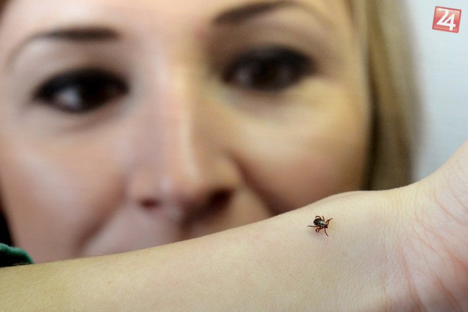 Ilustračný obrázok k článku RADÍME: Našli ste si kliešťa? Odborníci ho odporúčajú vykývať pinzetou