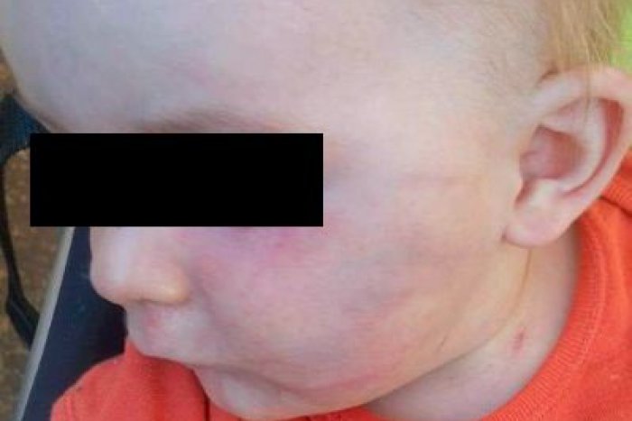 Ilustračný obrázok k článku Čo sa deje v slovenských škôlkach? V Košiciach mala úradovať opitá učiteľka, v Trnave vraj zbili dieťa