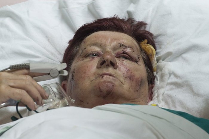 Ilustračný obrázok k článku Doráňaná Helena ostáva v Srbsku, netuší čo sa stalo: Zobudila som sa až v nemocnici