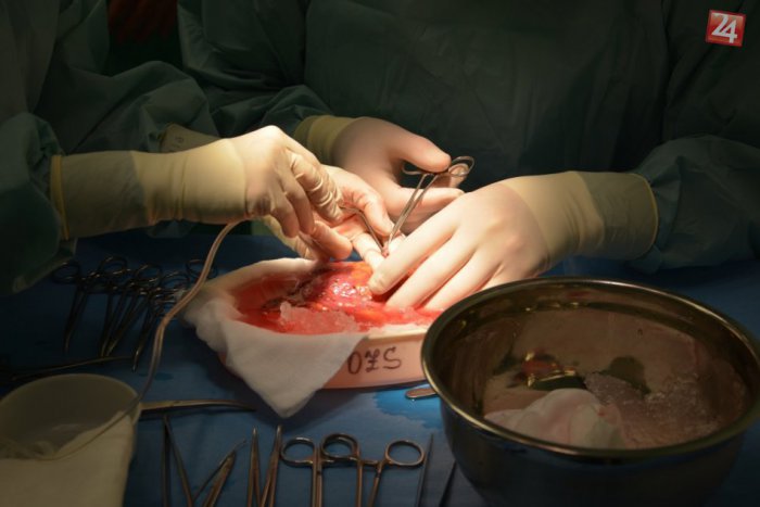 Ilustračný obrázok k článku Ochorenie obličiek netreba podceňovať: Ich zlyhanie zabilo vyše 600 ľudí