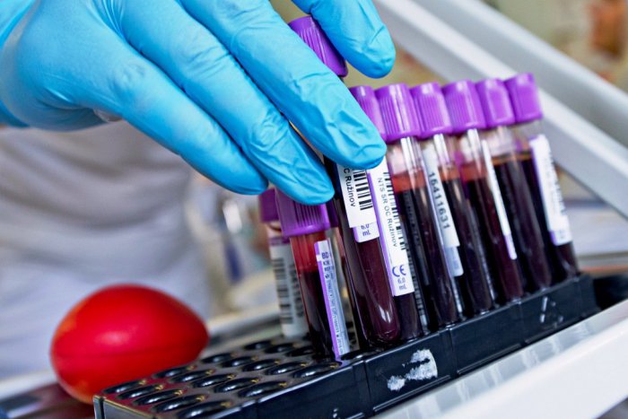 Ilustračný obrázok k článku V nemocnici majú po lete nedostatok krvi, menia preto odberové dni