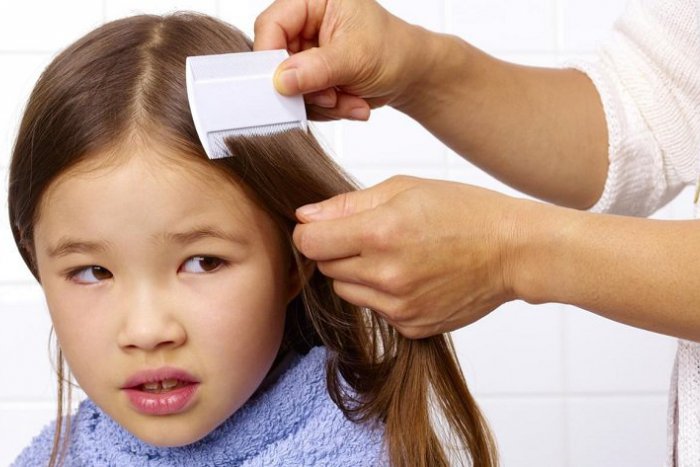 Ilustračný obrázok k článku Vši môže dostať aj vaše dieťa. Ako účinne bojovať proti parazitom?