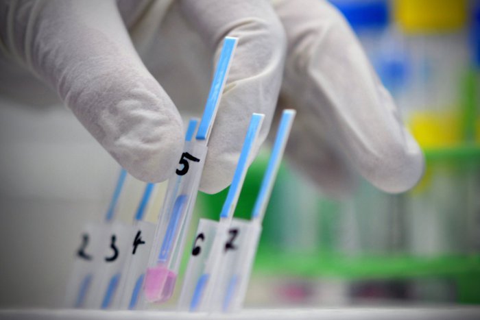 Ilustračný obrázok k článku V okrese Brezno nové prípady žltačky. Epidemiológovia vyzvali obchodné reťazce!