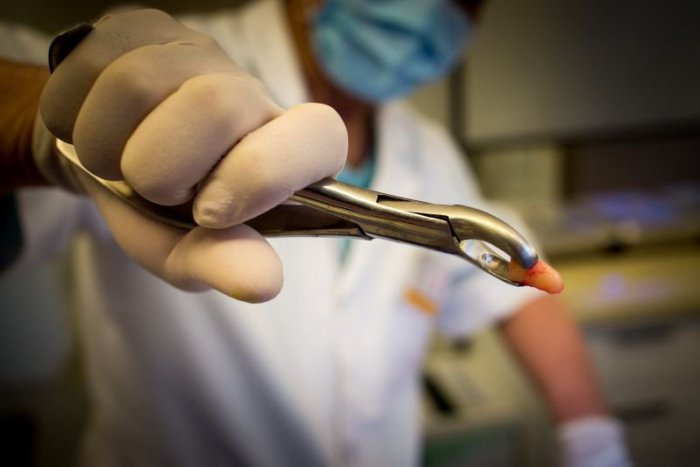 Ilustračný obrázok k článku Vybili ste si na svahu zub? Rýchlo s ním do mlieka!