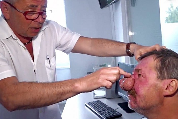 Ilustračný obrázok k článku SVET O SLOVENSKU: Briti tlieskajú nášmu zdravotníctvu