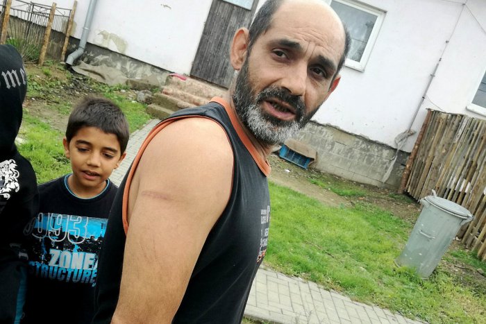 Marek Šivak ukazuje ranu po policajnom obušku.