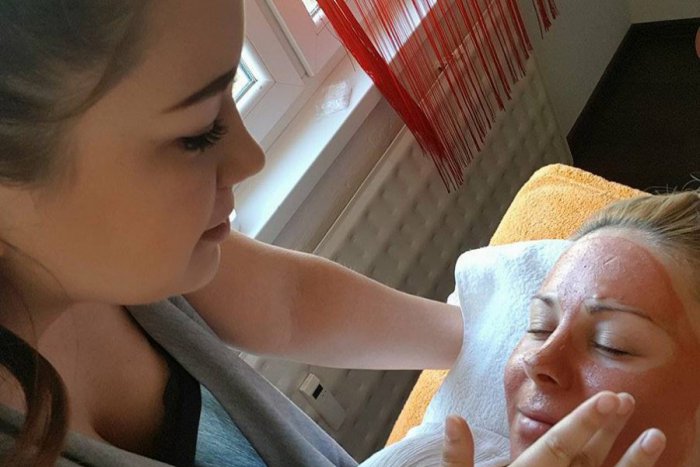 Ilustračný obrázok k článku Šikovná vizážistka z Brezna radí: 5 letných tipov na zdravú a krásnu pleť