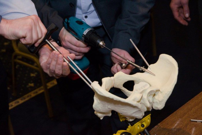 Ilustračný obrázok k článku V popradskej nemocnici zrealizovali unikátnu operáciu zlomeniny panvy