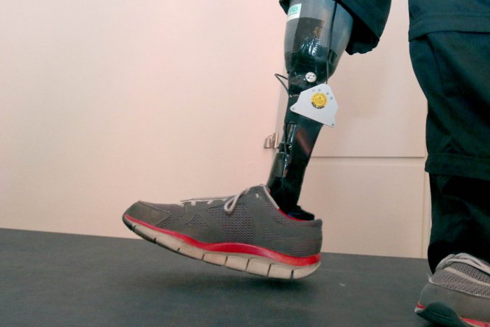 Ilustračný obrázok k článku SVET O SLOVENSKU: Najlepší vianočný darček? Nové nohy