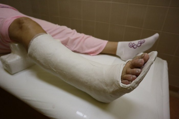 Ilustračný obrázok k článku Zima úradovala: K rekordu na žilinskej úrazovke prispeli aj tieto kuriózne prípady