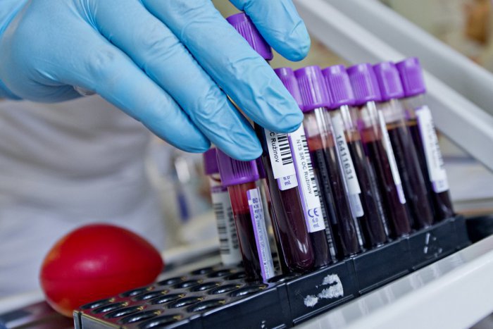 Ilustračný obrázok k článku Valentínsku kvapku krvi podporili Mondi SCP a OZ Ružomberčan