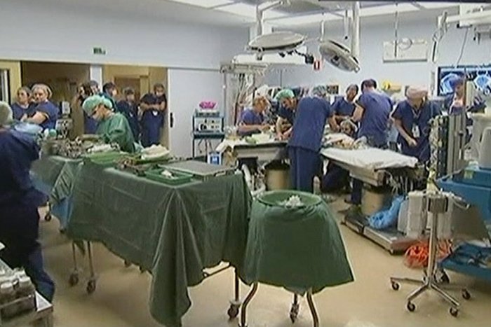 Ilustračný obrázok k článku Unikátna operácia: Tím maďarských chirurgov oddelil dvojičky zrastené hlavami