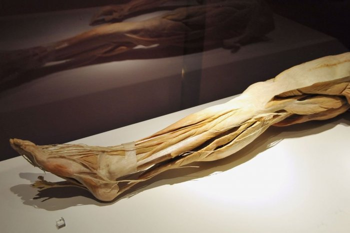 Ilustračný obrázok k článku Kniha o anatómii napísaná nacistami stále zachraňuje životy: Používajú ju chirurgovia