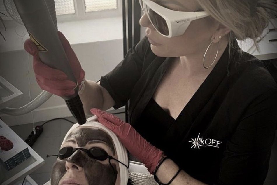 Ilustračný obrázok k článku Žilinčanka Tina (35) odstraňuje tetovania: Prečo ľudia svoje rozhodnutia ľutujú? FOTO