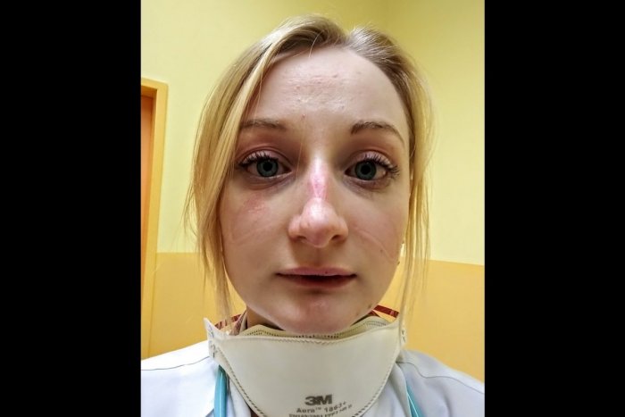 Ilustračný obrázok k článku Spoveď českej lekárky vyráža dych: Nejeme, nepijeme, na záchode som bola ani nepamätám...