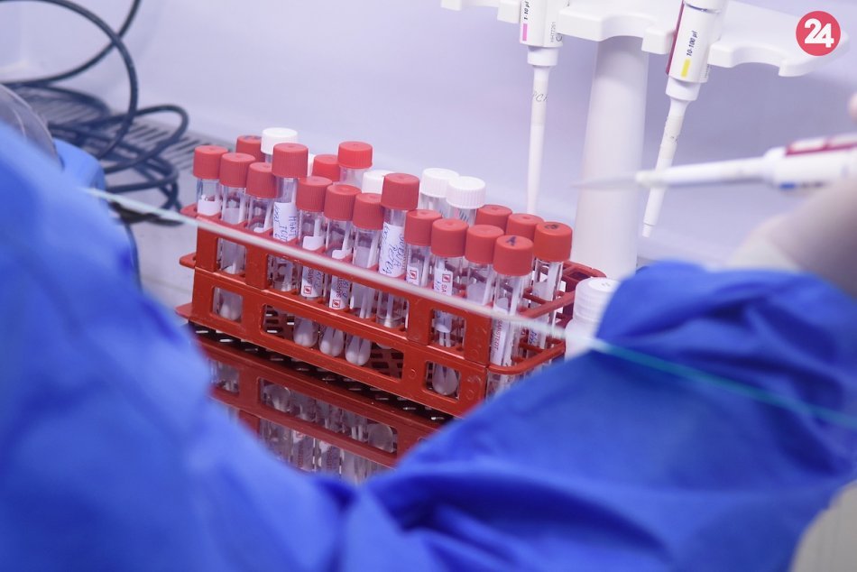 Ilustračný obrázok k článku Trnavský kraj je na tom horšie: Pribudlo vyše 500 nových prípadov