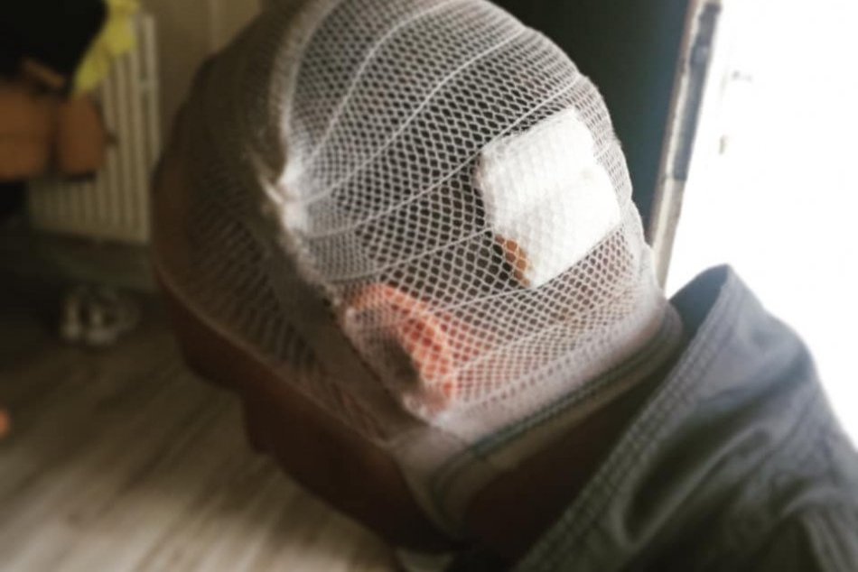 Ilustračný obrázok k článku Dráma v rodinnom dome: Brutálny útok Humenčana (40) na manželov pred očami detí