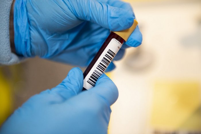 Ilustračný obrázok k článku Desiatky nových nakazených koronavírusom: Je medzi nimi aj dvojica z okresu Nové Zámky