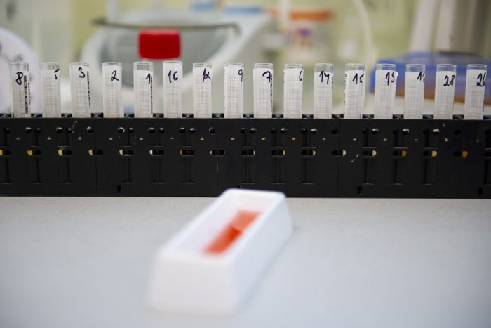 Ilustračný obrázok k článku Koronavírusu podľahli ďalší Slováci. Počet nakazených sa zvýšil  na 1 360