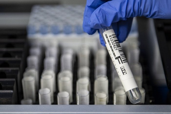 Ilustračný obrázok k článku Koronavírus na ministerstve: Jeden zo zamestnancov bol pozitívne testovaný