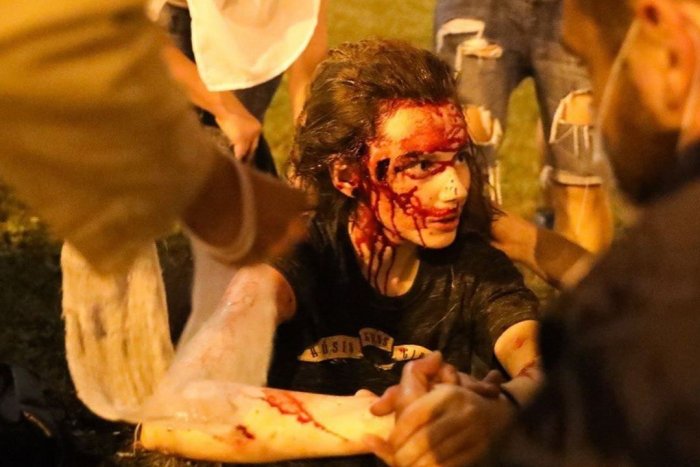 Ilustračný obrázok k článku Hrozivé zábery z Bieloruska: Protesty po voľbách sa premenili na JATKY! FOTO