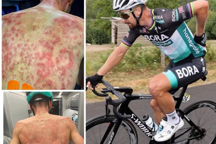 Ilustračný obrázok k článku Sagana a spol. zasiahla silná búrka: TAKTO ich dokaličili gigantické krúpy! FOTO a VIDEO