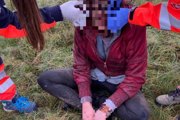 Ilustračný obrázok k článku Otrasný čin v Lučenci: Bezradné dievča prežilo so zraneniami 2 dni pod holým nebom!