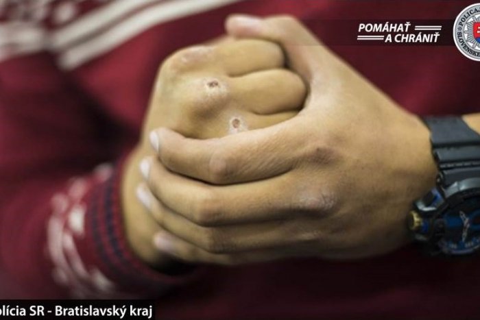 Ilustračný obrázok k článku Mladík zažil v Prešove na Wolkerovej bitku: Zmlátili a okradli ho dvaja útočníci