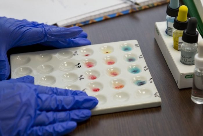 Ilustračný obrázok k článku Covid-19 nemá rád jednu krvnú skupinu. Máte ju aj vy?