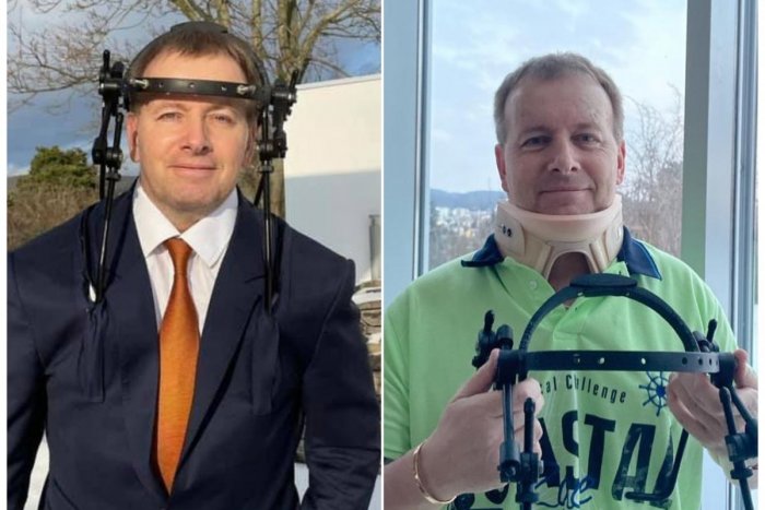 Ilustračný obrázok k článku Kollárovi zložili z hlavy železnú konštrukciu: A kolotoč mám dole, žartuje politik