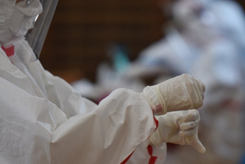 Ilustračný obrázok k článku Pribudli ďalšie desiatky nových obetí COVID-19. Aké sú aktuálne čísla?