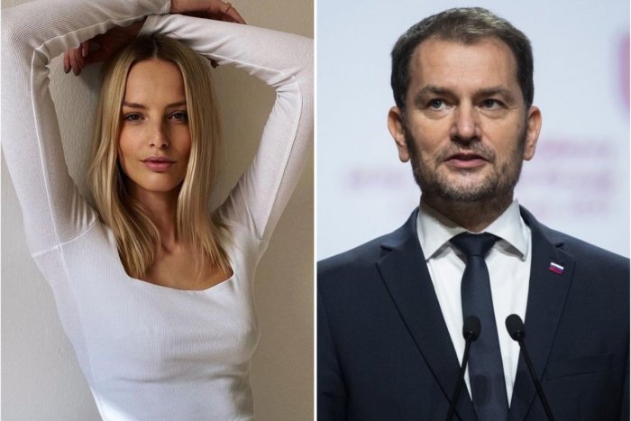 Ilustračný obrázok k článku Svetová topmodelka prišla s ponukou pre Matoviča: Čo by spravila, keby ODSTÚPIL?