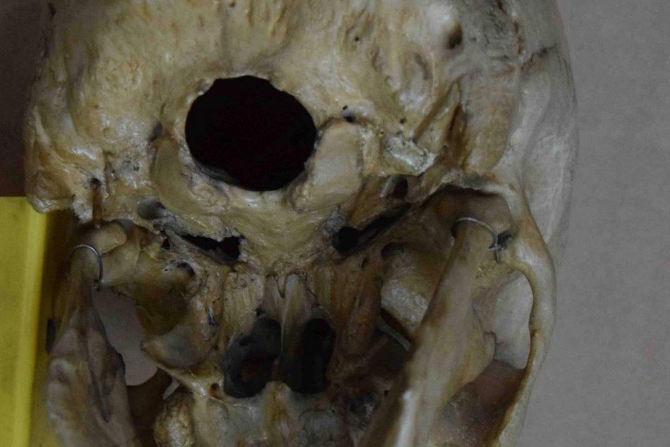 Ilustračný obrázok k článku Šokujúci nález na bystrickom sídlisku: V paneláku objavili ľudské lebky, FOTO