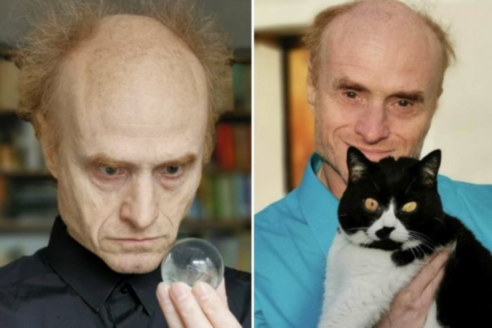 Ilustračný obrázok k článku Uznávaný vedec: Od mačiek sa NIKDY nenechajte hrýzť a driapať, môže to stáť život!