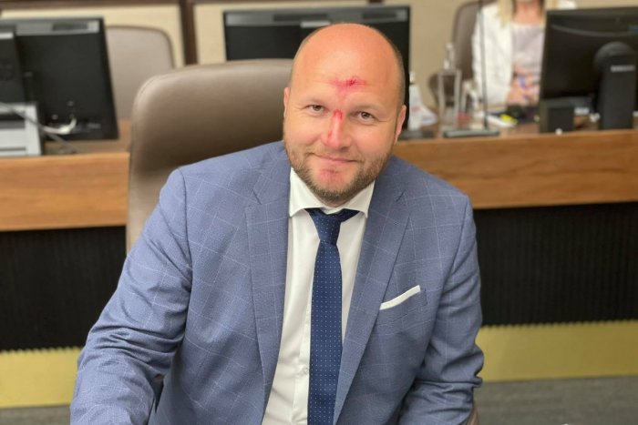 Ilustračný obrázok k článku Minister obrany prišiel na rokovanie vlády zakrvavený! Čo sa mu stalo?