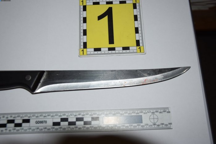 Ilustračný obrázok k článku Surový útok mladej ženy v Košiciach: Muža bodala odzadu, je ťažko zranený