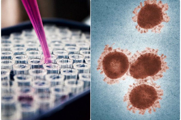 Ilustračný obrázok k článku Vedci varujú: Koronavírus vyčíňal už pred 20-tisíc rokmi a nemohli sa ho dlho ZBAVIŤ!