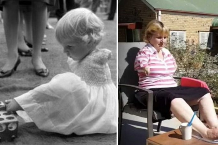 Ilustračný obrázok k článku Najdesivejší liek spred 60 rokov: Mal zabrániť nevoľnosti, zmrzačil 12-tisíc detí