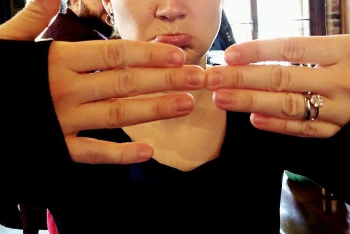 Ilustračný obrázok k článku Smskový pazúr, mobilový lakeť a ďalšie CHOROBY: Aj vám môže telefón zhoršiť život!